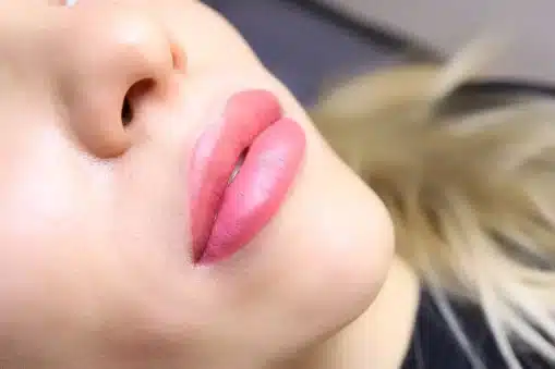 Anatomy of the Lips