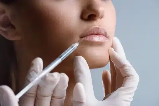 Botox Lip Flip Injection Techniques and Dosage