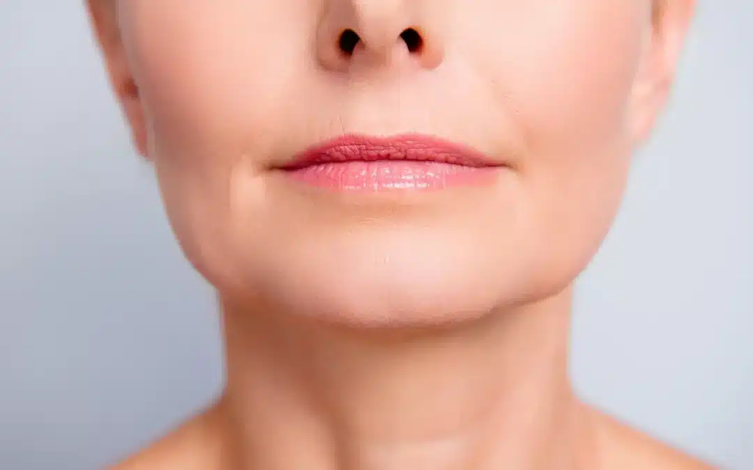 Managing Complex Cases: Dermal Fillers for Asymmetry and Structural Defects