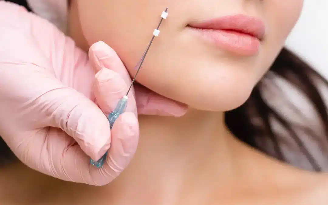 PDO vs. PLLA vs. PCL Threads: Choosing the Best Thread Lift Solutions for Your Practice
