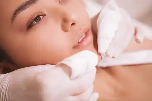 Best Chemical Peels for Acne AHA, BHA, or TCA A Dermatologist’s Guide