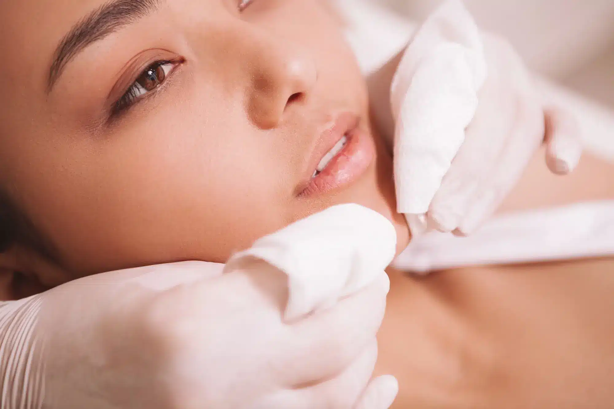 Best Chemical Peels for Acne: AHA vs BHA vs TCA 2025