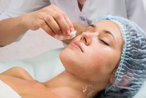 Chemical Peels for Face How to Get Rid of Wrinkles, Acne & Dark Spots