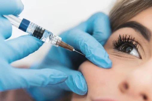 Protocols for Managing Filler Migration