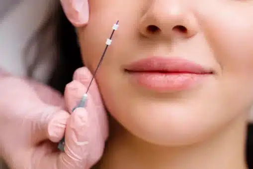Thread Lift Recovery & Aftercare Dos and Don’ts for Best Results